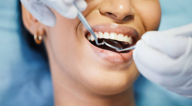 Best Emergency Wisdom Teeth Removal in Greenvle, IL
