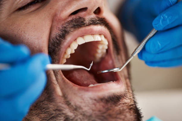 Best Emergency Tooth Extraction in Greenvle, IL